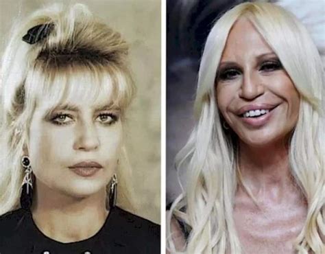 donatelka versace|Donatella Versace face what happened.